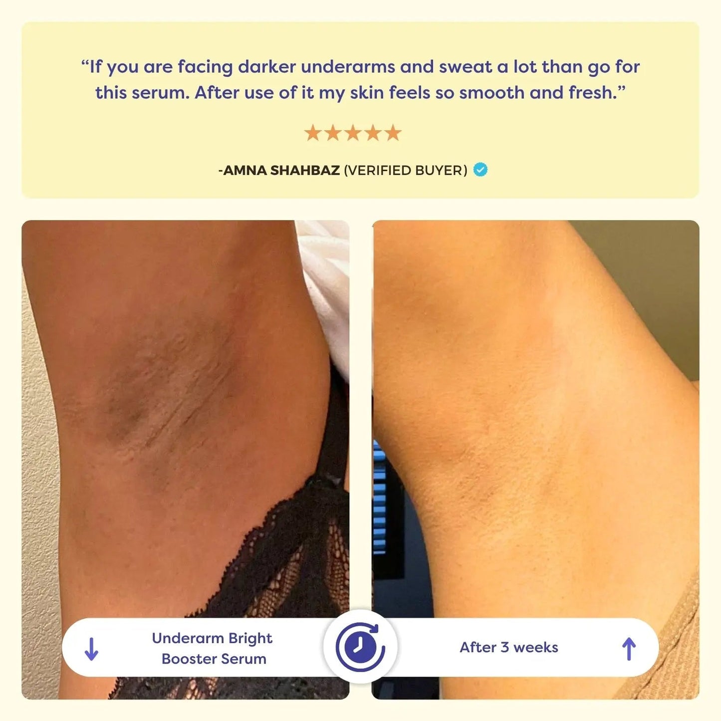 Underarm Brightening Serum