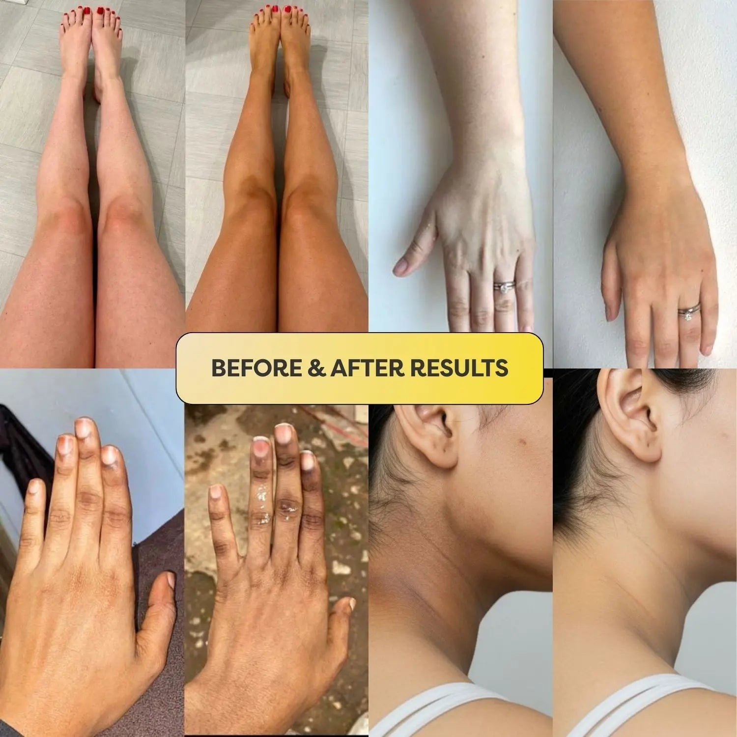 Turmeric Kojic Dark Spot Removal Scrub - KYND Beauty