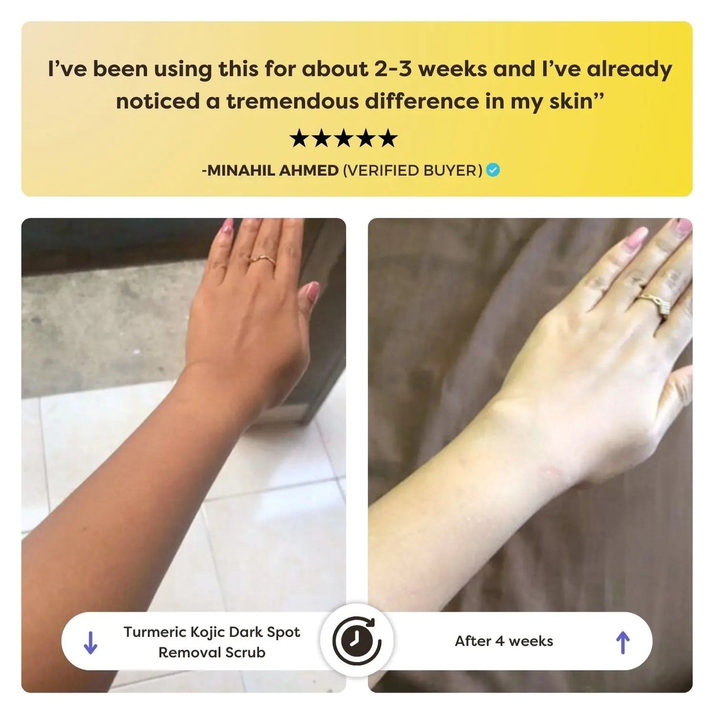 Turmeric Kojic Dark Spot Removal Scrub - KYND Beauty